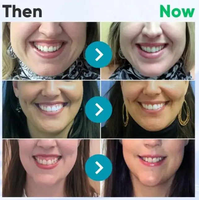 ODEIUN™ Bee Venom Dental Treatment Toothpaste