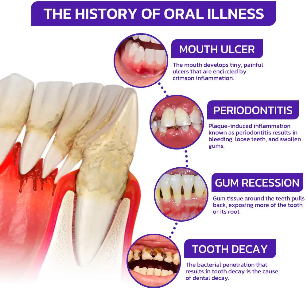 ODEIUN™ Bee Venom Dental Treatment Toothpaste