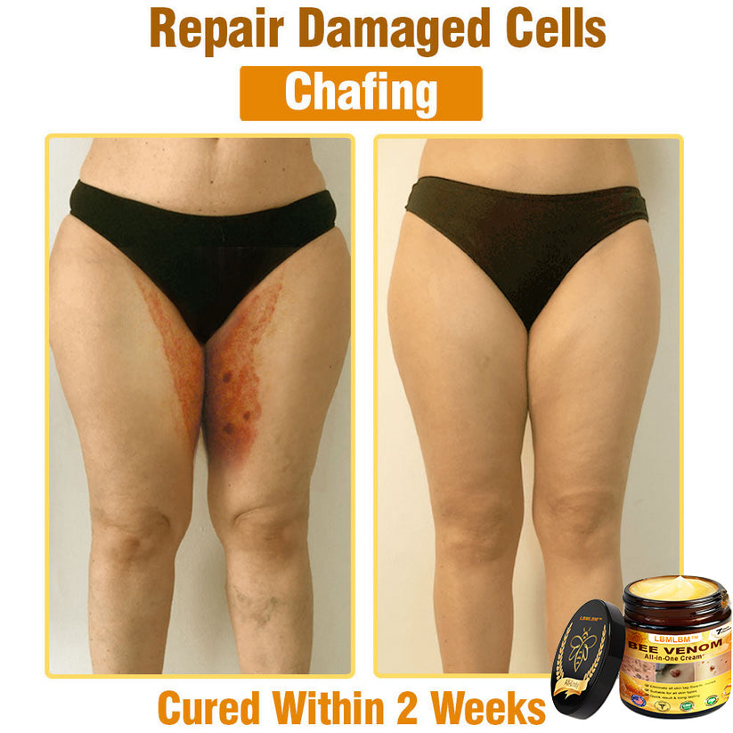 LBMLBM™ Bee Venom All-in-One Cream US Dermatologist Approved