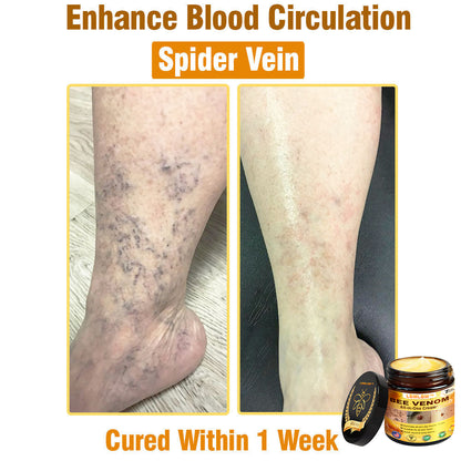 LBMLBM™ Bee Venom All-in-One Cream US Dermatologist Approved