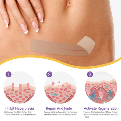 ✅Official Store |ODEIUN™ Hyaluronic Acid Nano Microneedle Repair Tape🏥(Treatment of old and new scars, reduction of surgical scars, stretch marks, keloids, acne, burns, warts, dermatomes and varicose veins)