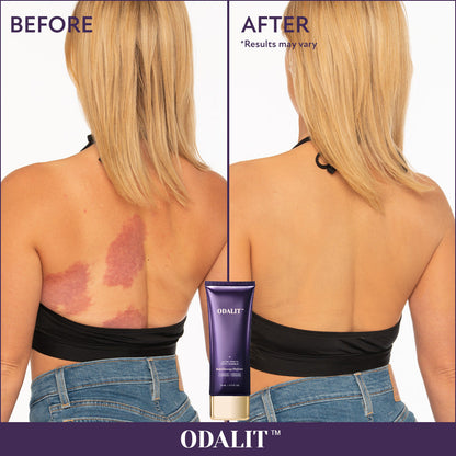 🔥Last Day 80% OFF✨Body Coverage Perfector