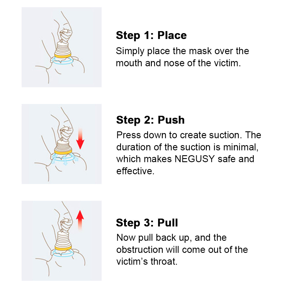 NEGUSY - The Choking Rescue Device❤️Save your loved ones from choking