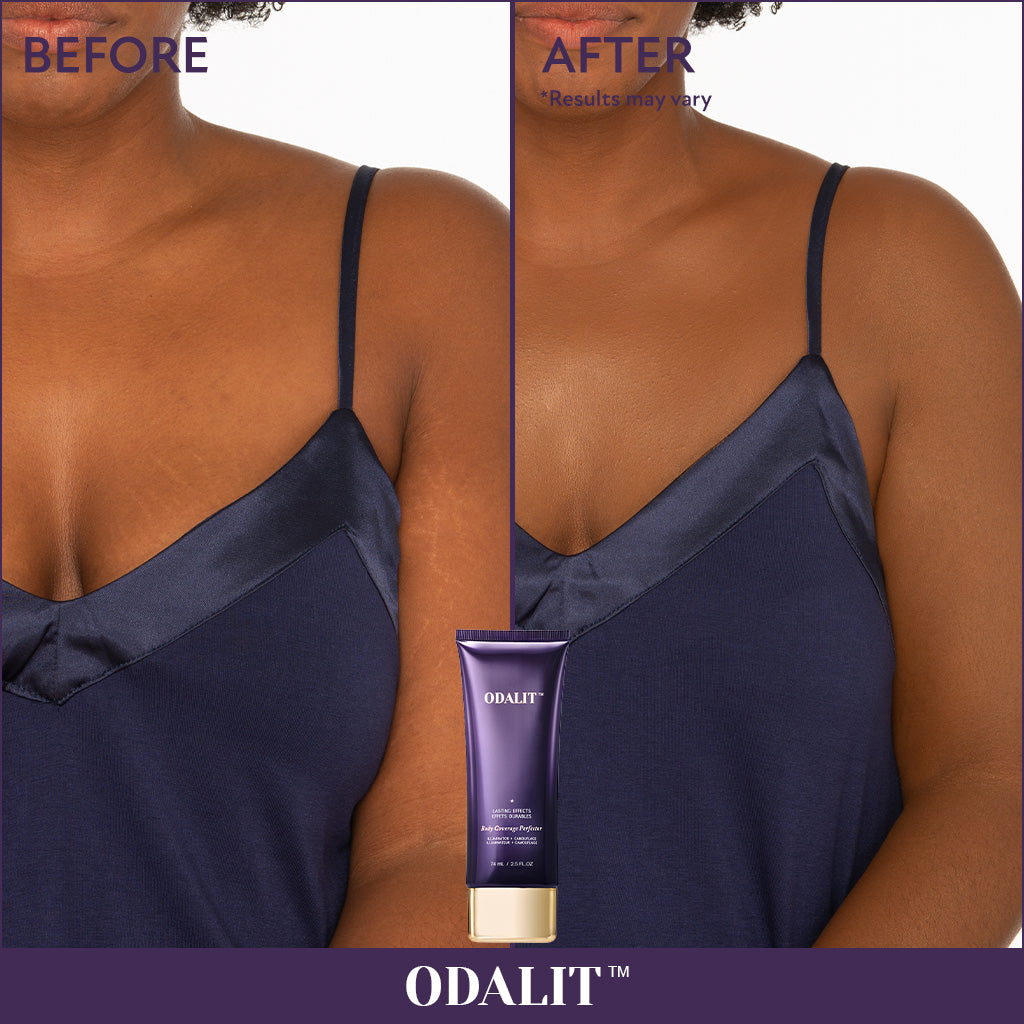 🔥Last Day 80% OFF✨Body Coverage Perfector