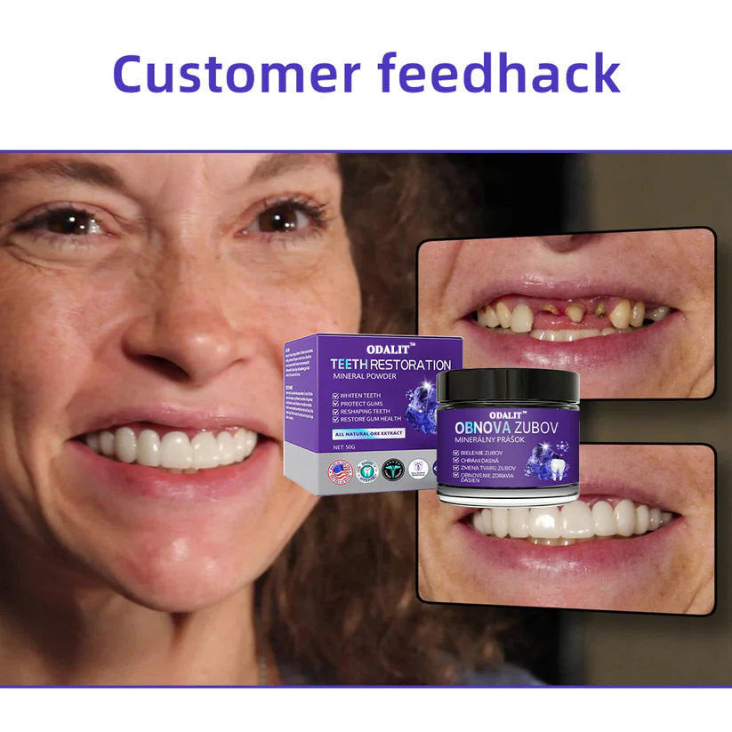 🎁Flash Sale - Don’t Miss Out - ODALIT™ TeethRestoration Mineral Powder🦷(ADA recommended)👩‍⚕️(Treats periodontitis and mouth ulcers, prevents tooth loss, and repairs gum recession)