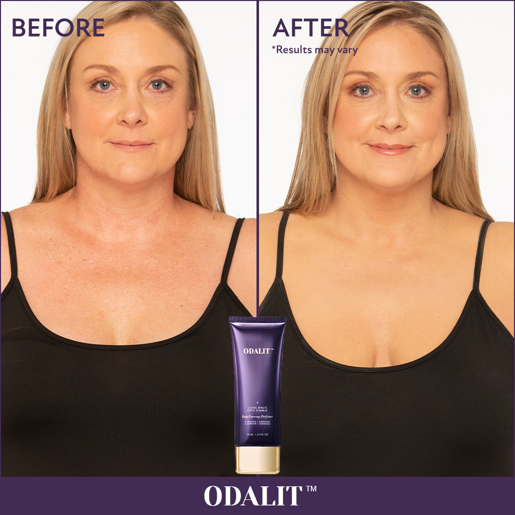 🔥Last Day 80% OFF✨Body Coverage Perfector