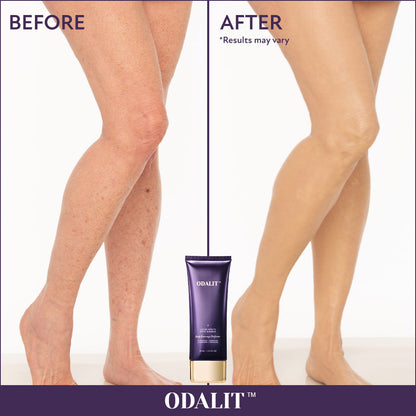 🔥Last Day 80% OFF✨Body Coverage Perfector