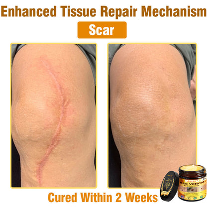 LBMLBM™ Bee Venom All-in-One Cream US Dermatologist Approved