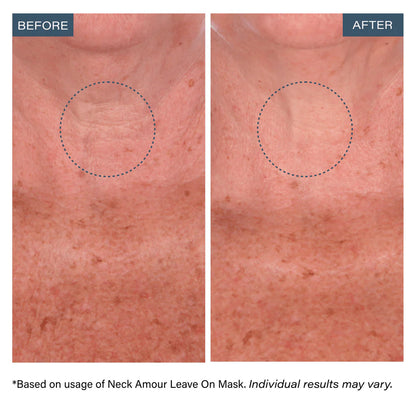 Neck Amour Leave-On Neck Mask