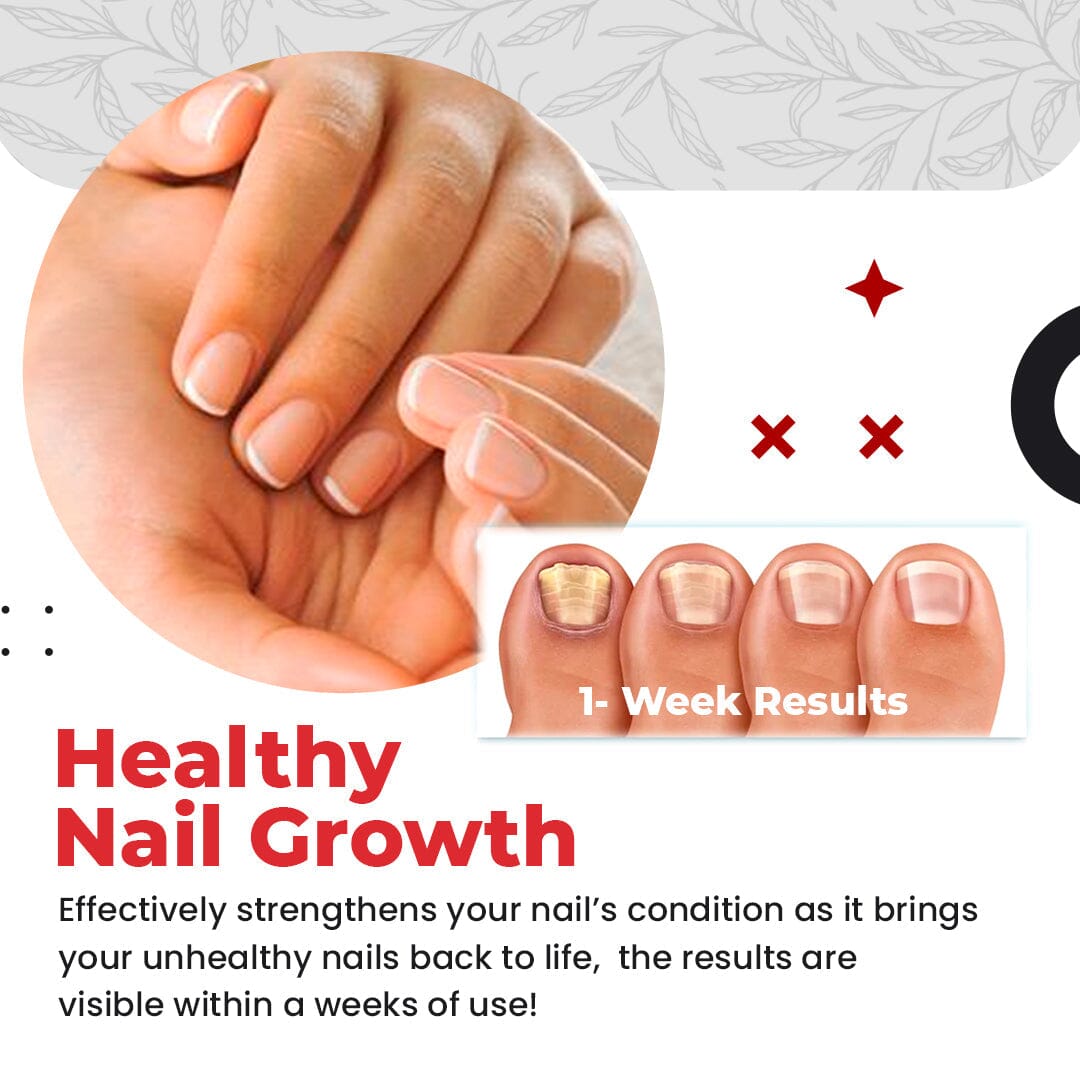 ToenailPro™ Anti Fungus Relief Oil