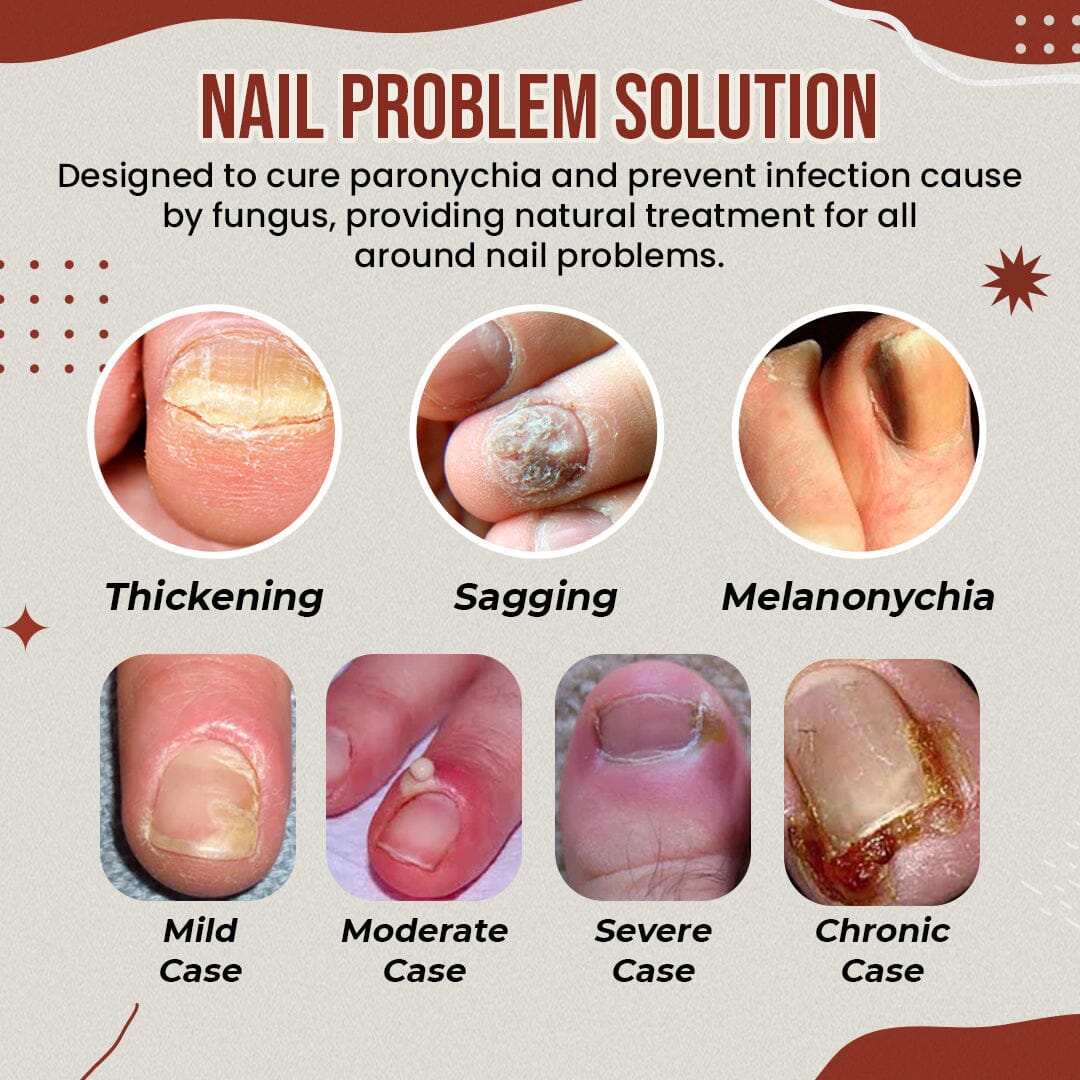 Anti-Onychomycosis Socks