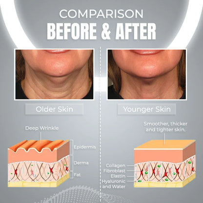 ContourPro™ Sleeping V-Face Beauty Device