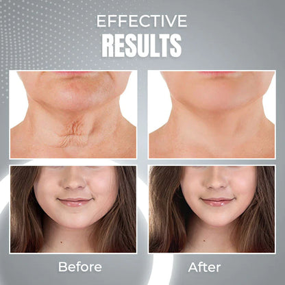 ContourPro™ Sleeping V-Face Beauty Device