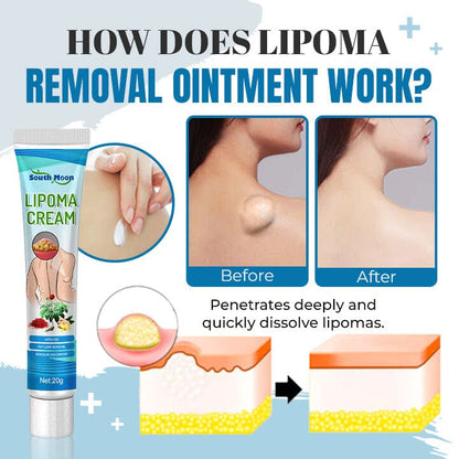 Lipoma Removal Ointment