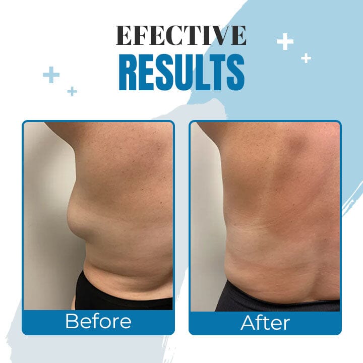 Lipoma Removal Ointment