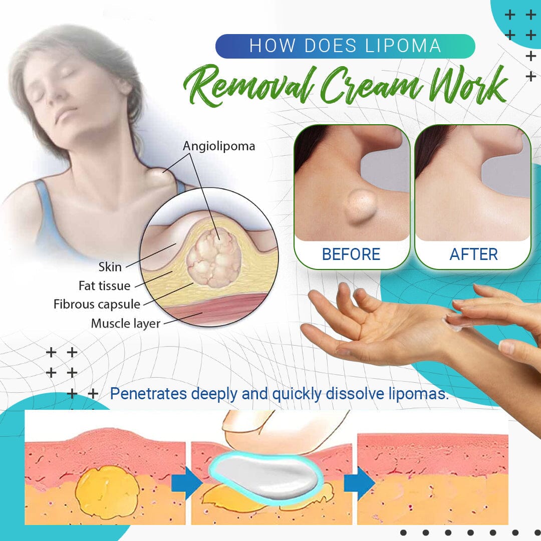 LumpFree™ Lipoma Removal Cream