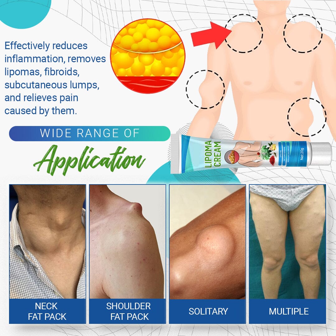 LumpFree™ Lipoma Removal Cream