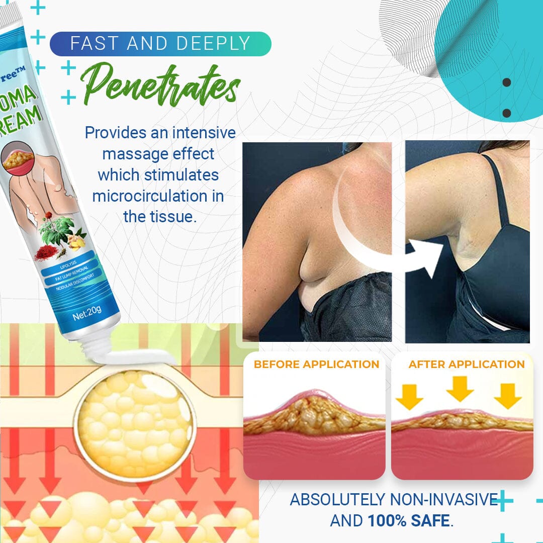 LumpFree™ Lipoma Removal Cream