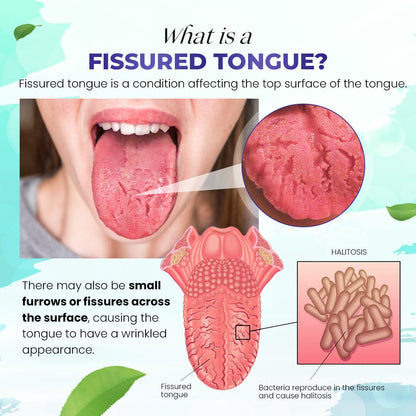 Canada Polumna™ Fissured Tongue Relief Spray