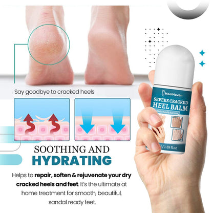 HeelHaven™ Severe Cracked Heel Balm
