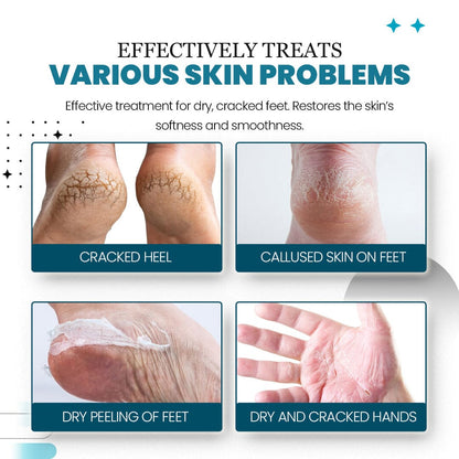 HeelHaven™ Severe Cracked Heel Balm